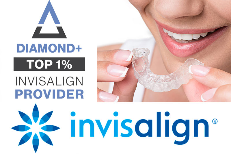 Invisalign in Sacramento