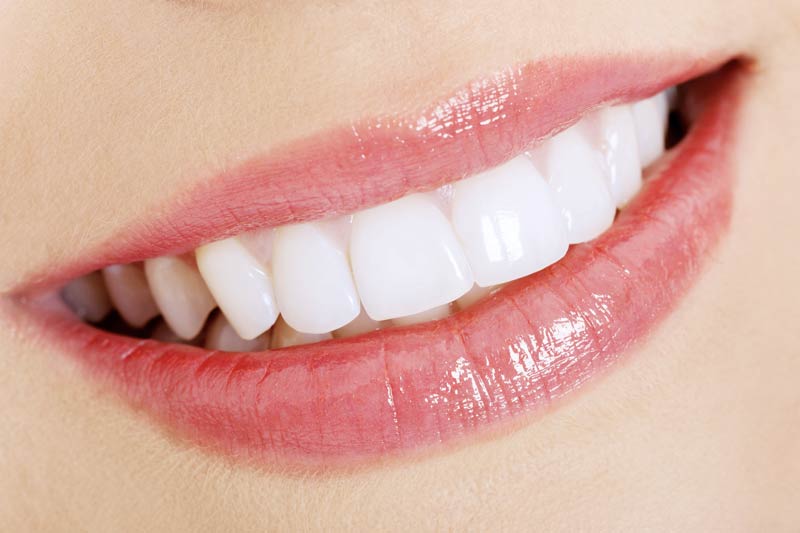 Cosmetic Dentistry in Sacramento