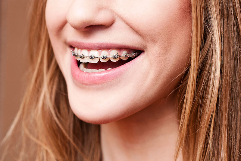 Orthodontics in Sacramento