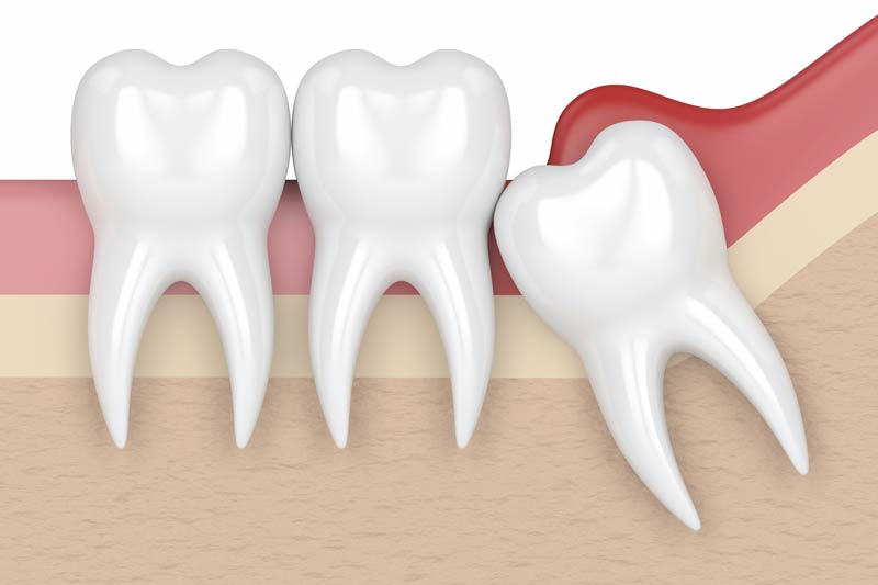 Orthodontics in Sacramento